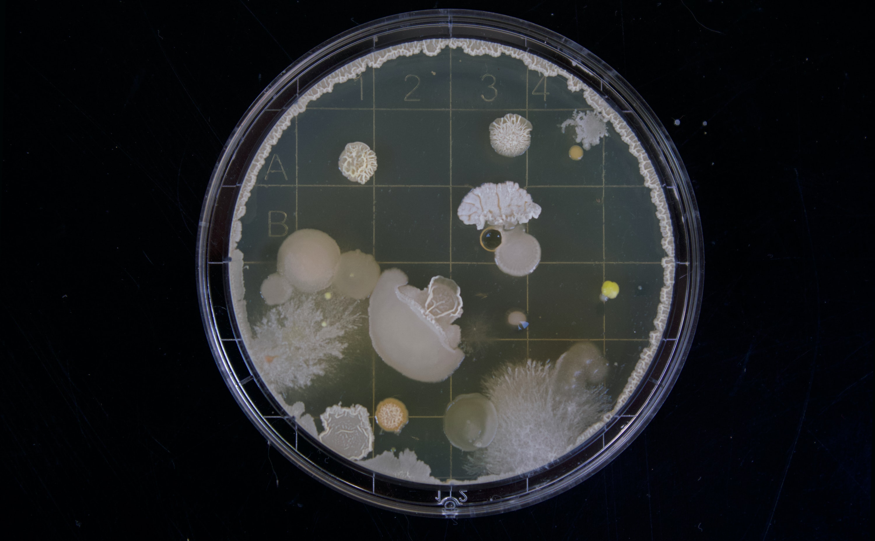 Petri dish with bacteria samples.